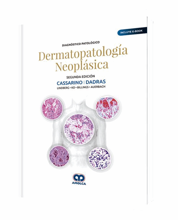 DIAGNOSTICO PATOLOGICO DERMATOPATOLOGIA NEOPLASICA 2 EDICION