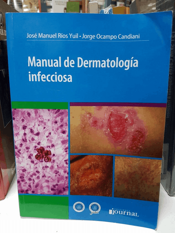 Manual de dermatologia infecciosa