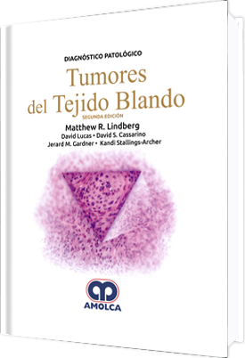 DIAGNOSTICO PATOLOGICO: TUMORES DEL TEJIDO BLANDO