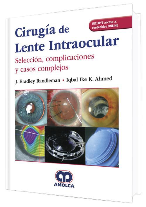 CIRUGIA DE LENTE INTRAOCULAR