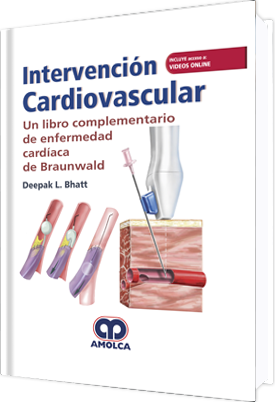 INTERVENCION CARDIOVASCULAR