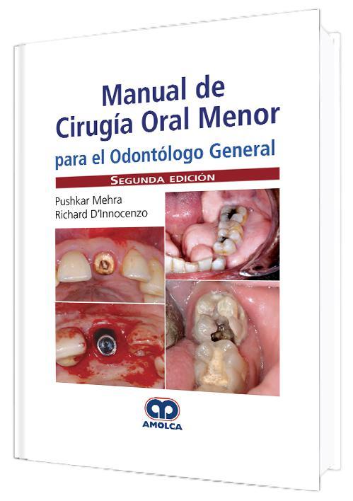 MANUAL DE CIRUGIA ORAL MENOR