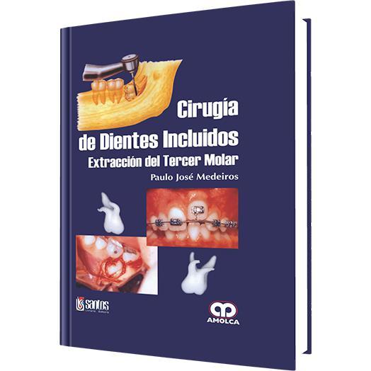 Cirugia de Dientes Incluidos
