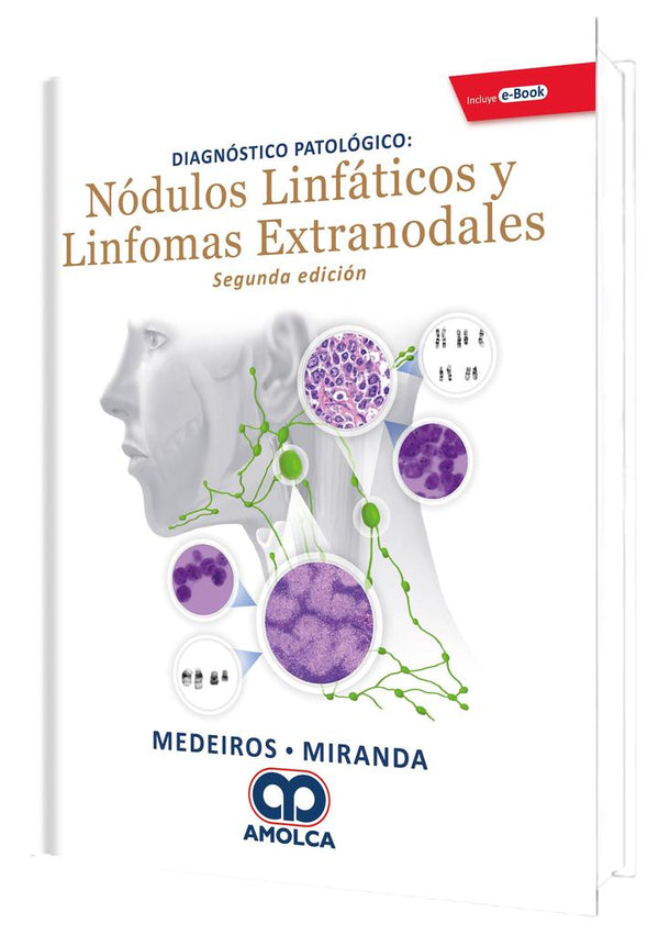 Diagnostico Patologico: Nodulos Linfaticos y Linfomas Extranodales 2 edicion